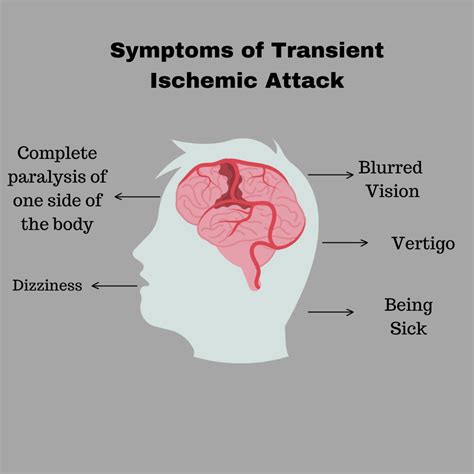 old black women fucking|Transient ischemic attack (TIA)